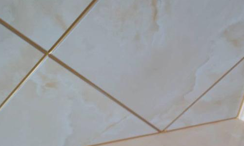 美縫人工費(fèi)