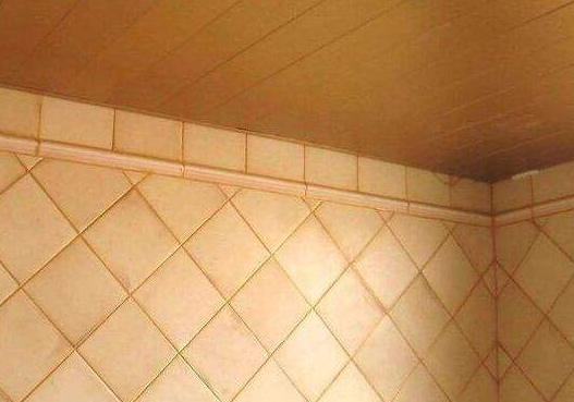 美縫按什么收費(這幾種收費方式最常見)(圖1) 美縫按什么收費