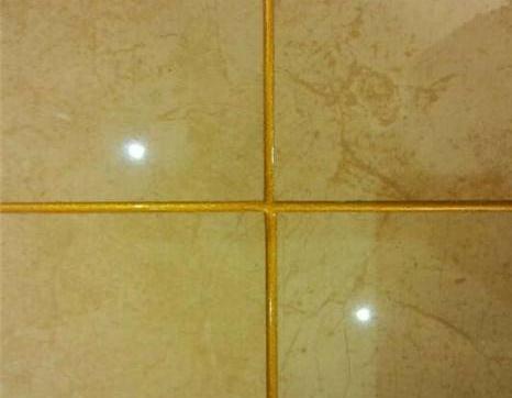 做的白色美縫變黃了